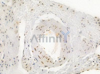 Phospho-53BP1 (Thr543) Antibody - DF2978 at 1/100 staining human normal liver tissue by IHC-P.