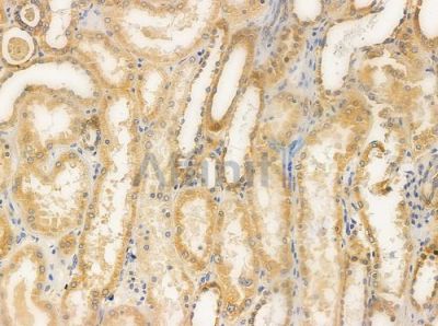 Acetyl-alpha-Tubulin (Lys40) Antibody - DF2982 at 1/100 staining human normal kidney tissue by IHC-P.