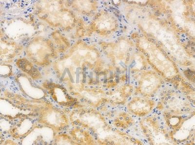 Acetyl-alpha-Tubulin (Lys40) Antibody - DF2982 at 1/100 staining human normal kidney tissue by IHC-P.