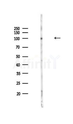 Phospho-alpha 1 Catenin (Ser655/Thr658) Antibody - Western blot analysis of lysates from Mouse lung, using Phospho-alpha 1 Catenin (Ser655/Thr658) Antibody at 1/1000 dilution.