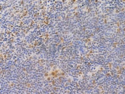 SAMHD1 Antibody - DF2987 at 1/100 staining human normal tonsil tissue by IHC-P.
