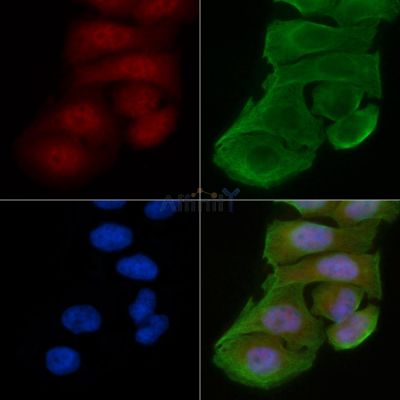 Phospho-ACK1 (Tyr857/Tyr858)[Tyr859/Tyr860] Antibody - DF2998 staining Hela cells(30min of UV treatment) by IF/ICC.
