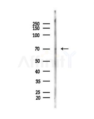 CDC7 Antibody - Western blot analysis of lysates from Hela cells(heat-shock, 45min treatment), using CDC7 Antibody at 1/1000 dilution.