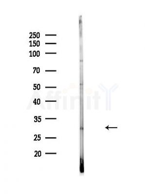 OVOL1 Antibody - Western blot analysis of lysates from MDA-MB-231 cells(heat-shock,45min treatment), using OVOL1 Antibody at 1/1000 dilution.
