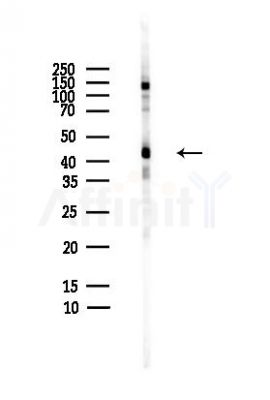 BCKD Antibody - Western blot analysis of lysates from HepG2 cells(heat-shock,45min treatment), using BCKD Antibody at 1/1000 dilution.