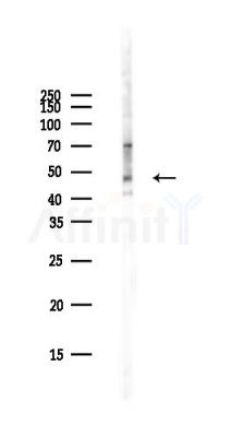BCKD Antibody - Western blot analysis of lysates from PC12 cells(starvation,24h treatment), using BCKD Antibody at 1/1000 dilution.