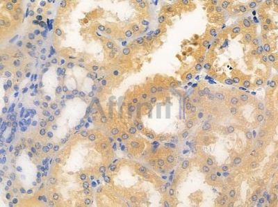 ANP32C Antibody - DF3021 at 1/100 staining human normal kidney tissue by IHC-P.