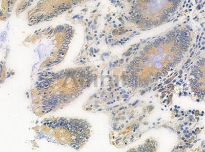 AKAP8 Antibody - DF3025 at 1/100 staining human normal colon tissue by IHC-P.