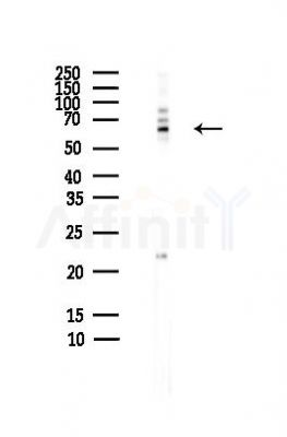 hnRNP Q Antibody - Western blot analysis of lysates from HepG2 cells(heat-shock,45min treatment), using hnRNP Q Antibody at 1/1000 dilution.