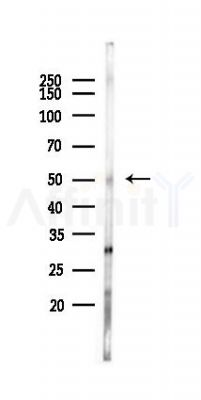 SUPT3H Antibody - Western blot analysis of lysates from Rat liver, using SUPT3H Antibody at 1/1000 dilution.