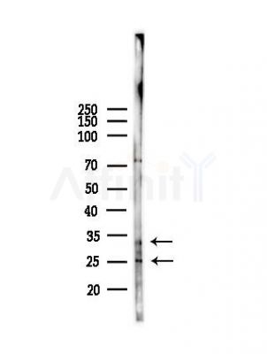 SIX6 Antibody - Western blot analysis of lysates from B16F10-LUC cells(heat-shock,45min treatment), using SIX6 Antibody at 1/1000 dilution.