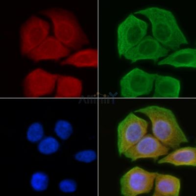 HEXB Antibody - DF3074 staining Hela cells(45min of heat-shock) by IF/ICC.