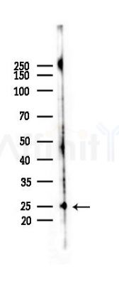 HMGB1 Antibody - Western blot analysis of lysates from COLO205 cells(heat-shock,45min treatment), using HMGB1 Antibody at 1/1000 dilution.