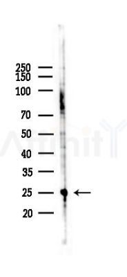 HMGB1 Antibody - Western blot analysis of lysates from A375 cells(heat-shock,45min treatment), using HMGB1 Antibody at 1/1000 dilution.
