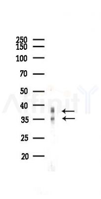 hnRNP A1 Antibody - Western blot analysis of lysates from Rat liver, using hnRNP A1 Antibody at 1/1000 dilution.