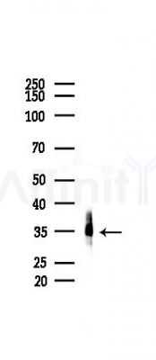 hnRNP A1 Antibody - Western blot analysis of lysates from COLO205 cells(heat-shock,45min treatment), using hnRNP A1 Antibody at 1/1000 dilution.