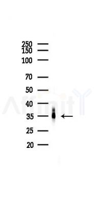 hnRNP A1 Antibody - Western blot analysis of lysates from A375 cells(heat-shock,45min treatment), using hnRNP A1 Antibody at 1/1000 dilution.