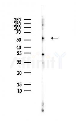 FGR Antibody - Western blot analysis of lysates from HepG2 cells(heat-shock,45min treatment), using FGR Antibody at 1/1000 dilution.