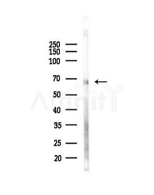 HKR1 Antibody - Western blot analysis of lysates from Mouse testis, using HKR1 Antibody at 1/1000 dilution.