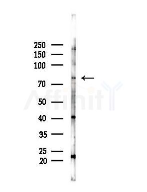 SKIL Antibody - Western blot analysis of lysates from A375 cells(heat-shock,45min treatment), using SKIL Antibody at 1/1000 dilution.