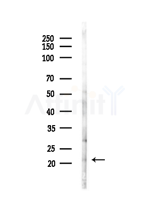 ATF3 Antibody - Western blot analysis of lysates from HepG2 cells(LPS,4h treatment), using ATF3 Antibody at 1/1000 dilution.