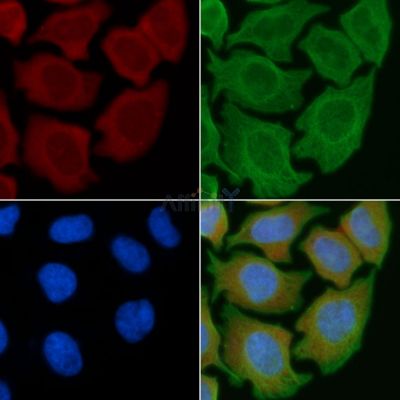 TSPAN8 Antibody - DF3111 staining Hela cells(45min of heat-shock) by IF/ICC.