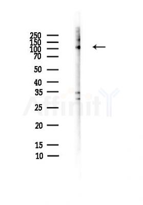Hexokinase 1 Antibody - Western blot analysis of lysates from HepG2 cells(heat-shock,45min treatment), using Hexokinase 1 Antibody at 1/1000 dilution.