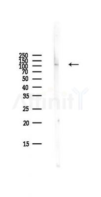 Hexokinase 1 Antibody - Western blot analysis of lysates from Mouse lung, using Hexokinase 1 Antibody at 1/1000 dilution.