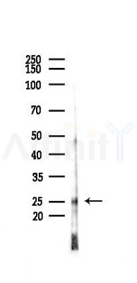 HMGB2 Antibody - Western blot analysis of lysates from COLO205 cells(heat-shock,45min treatment), using HMGB2 Antibody at 1/1000 dilution.