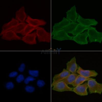 IP3KB Antibody - DF3140 staining Hela cells(30min of UV treatment) by IF/ICC.