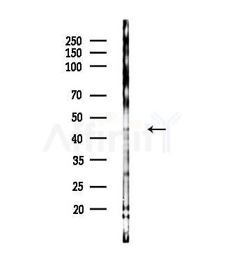 KAP1 Antibody - Western blot analysis of lysates from MCF7 cells(heat-shock,45min treatment), using KAP1 Antibody at 1/1000 dilution.