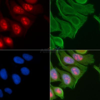 CIITA Antibody - DF3157 staining Hela cells(45min of heat-shock) by IF/ICC.