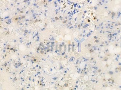 BUD31 Antibody - DF3175 at 1/100 staining human normal lung tissue by IHC-P.