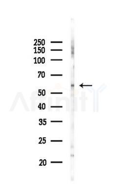 CSK Antibody - Western blot analysis of lysates from Mouse lung, using CSK Antibody at 1/1000 dilution.