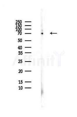 YAP Antibody - Western blot analysis of lysates from HepG2 cells(heat-shock,45min treatment), using YAP Antibody at 1/1000 dilution.