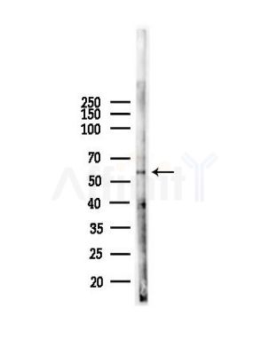 CDK8 Antibody - Western blot analysis of lysates from B16F10-LUC cells(heat-shock,45min treatment), using CDK8 Antibody at 1/1000 dilution.