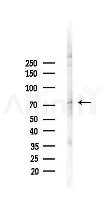 BMX Antibody - Western blot analysis of lysates from K562 cells(UV,30min treatment), using BMX Antibody at 1/1000 dilution.