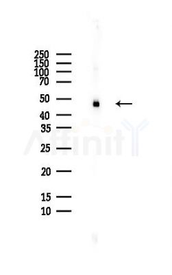 hnRNP F Antibody - Western blot analysis of lysates from HepG2 cells(heat-shock,45min treatment), using hnRNP F Antibody at 1/1000 dilution.