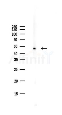 hnRNP F Antibody - Western blot analysis of lysates from PC12 cells(starvation,24h treatment), using hnRNP F Antibody at 1/1000 dilution.