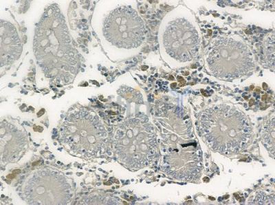 LIMK2 Antibody - DF3211 at 1/100 staining human normal colon tissue by IHC-P.