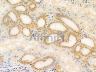 ADK Antibody - DF3218 at 1/100 staining human normal kidney tissue by IHC-P.