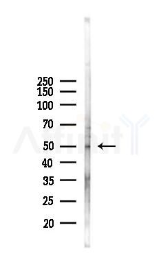 COPS2 Antibody - Western blot analysis of lysates from COLO205 cells(heat-shock,45min treatment), using COPS2 Antibody at 1/1000 dilution.