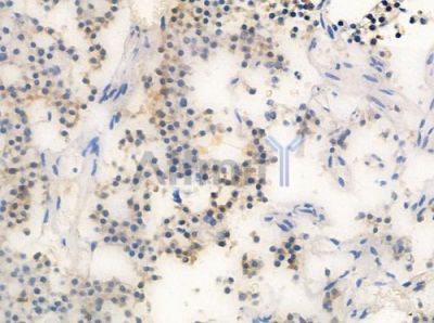 LMO4 Antibody - DF3223 at 1/100 staining human pituitary adenoma by IHC-P.