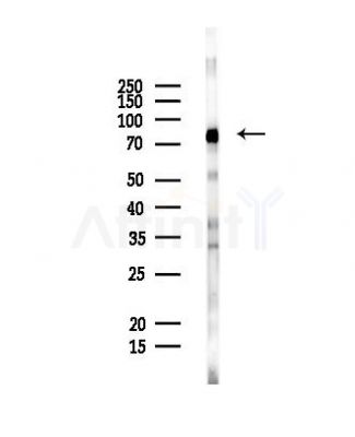 ADARB1 Antibody - Western blot analysis of lysates from PC12 cells, using ADARB1 Antibody at 1/1000 dilution.