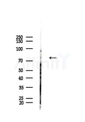 FOXK1 Antibody - Western blot analysis of lysates from HepG2 cells(heat-shock,45min treatment), using FOXK1 Antibody at 1/1000 dilution.