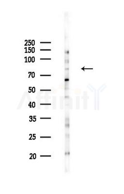 SFRS17A Antibody - Western blot analysis of lysates from K562 cells(UV,30min treatment), using SFRS17A Antibody at 1/1000 dilution.