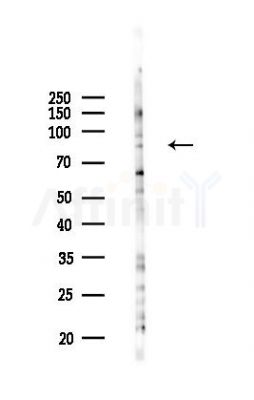 SFRS17A Antibody - Western blot analysis of lysates from B16F10-LUC cells(UV,30min treatment), using SFRS17A Antibody at 1/1000 dilution.
