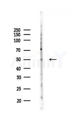 CSTF1 Antibody - Western blot analysis of lysates from K562 cells(UV,30min treatment), using CSTF1 Antibody at 1/1000 dilution.
