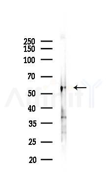 FOXC1/2 Antibody - Western blot analysis of lysates from B16F10-LUC cells(uv30min treatment), using FOXC1/2 Antibody at 1/1000 dilution.