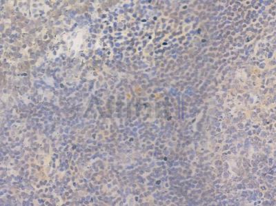 KLF Antibody - DF3259 at 1/100 staining human normal tonsil tissue by IHC-P.
